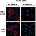 SMC-616_PPM1H_Antibody_10D2_ICC-IF_Hu-Ms-Rt_Alveolar-Basal-Epithelial-cells-A549_63x_1.png