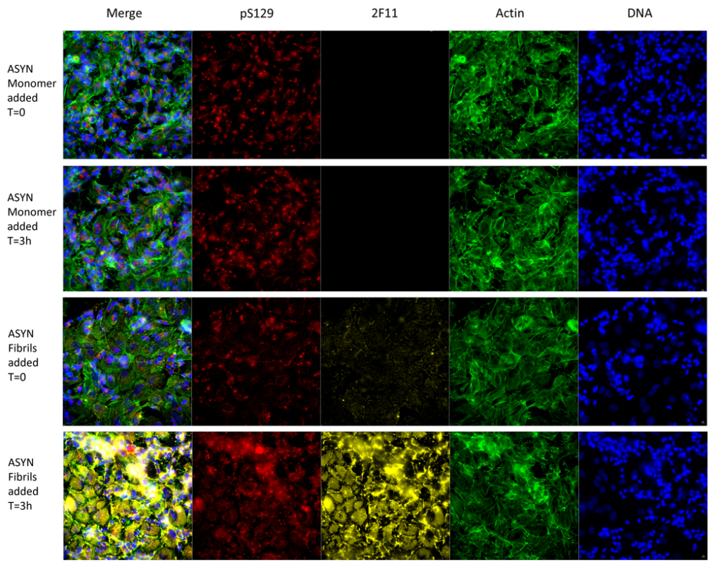 <p>8 Day differentiated SH-SY5Y cells with added alpha synuclein monomers (SPR-321; 5µg) or fibrils (SPR-322; 5µg) at time zero and 3h time points. Staining and channels phospho-ser129 (ab51253) and secondary DaRb-647; 2F11 (1:1000 dilution, DaMs-555); Actin stain (Phalloidin dye: 488nm); DNA (Hoechst dye, 405nm). Top two images: T=0, T=3h, no signal change from 2F11 showing that alpha synuclein monomers do not bind the antibody. Bottom two images: T=0, T=3h. 2F11 channel clearly shows a large increase in fibril signal entering the cells by 3h, with a concomitant increase in phspho-Ser129 signal.</p>
