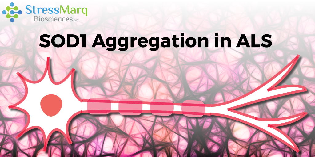SOD1 Aggregation in ALS