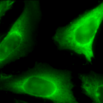 SPC-100_Hsp40_Antibody_ICC-IF_Human_Heat-Shocked-HeLa-Cells_100x_Composite.png