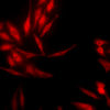 Rabbit Anti-Hsp40 Antibody used in Immunocytochemistry/Immunofluorescence (ICC/IF) on Human Heat Shocked HeLa Cells (SPC-100)