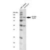 Rabbit Anti-GRP94 Antibody used in Western blot (WB) on Rat brain cell lysates (SPC-101)