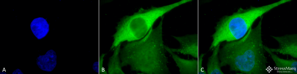 <p>Immunocytochemistry/Immunofluorescence analysis using Rabbit Anti-Hsp70 Polyclonal Antibody (SPC-103). Tissue: Heat Shocked Cervical cancer cell line (HeLa). Species: Human. Fixation: 2% Formaldehyde for 20 min at RT. Primary Antibody: Rabbit Anti-Hsp70 Polyclonal Antibody (SPC-103) at 1:100 for 12 hours at 4°C. Secondary Antibody: FITC Goat Anti-Rabbit (green) at 1:200 for 2 hours at RT. Counterstain: DAPI (blue) nuclear stain at 1:40000 for 2 hours at RT. Localization: Cytoplasm. Magnification: 100x. (A) DAPI (blue) nuclear stain. (B) Anti-Hsp70 Antibody. (C) Composite. Heat Shocked at 42°C for 1h.</p>
