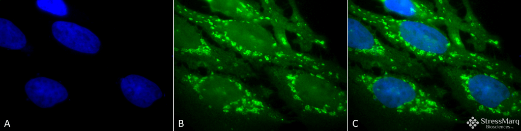 <p>Immunocytochemistry/Immunofluorescence analysis using Rabbit Anti-Hsp60 Polyclonal Antibody (SPC-105). Tissue: Heat Shocked Cervical cancer cell line (HeLa). Species: Human. Fixation: 2% Formaldehyde for 20 min at RT. Primary Antibody: Rabbit Anti-Hsp60 Polyclonal Antibody (SPC-105) at 1:100 for 12 hours at 4°C. Secondary Antibody: FITC Goat Anti-Rabbit (green) at 1:200 for 2 hours at RT. Counterstain: DAPI (blue) nuclear stain at 1:40000 for 2 hours at RT. Localization: Mitochondrion matrix. Magnification: 100x. (A) DAPI (blue) nuclear stain. (B) Anti-Hsp60 Antibody. (C) Composite. Heat Shocked at 42°C for 1h.</p>
