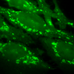 SPC-105_Hsp60_Antibody_ICC-IF_Human_Heat-Shocked-HeLa-Cells_100x_Composite.png