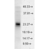 Rabbit Anti-HSP27 Antibody used in Western blot (WB) on Human Cervical cancer cell line (HeLa) lysate (SPC-106)