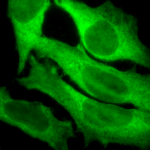 SPC-106_Hsp27_Antibody_ICC-IF_Human_Heat-Shocked-HeLa-Cells_100x_Composite.png