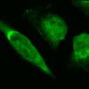 Rabbit Anti-GRP78 Antibody used in Immunocytochemistry/Immunofluorescence (ICC/IF) on Human Heat Shocked HeLa Cells (SPC-107)