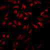 Rabbit Anti-GRP78 Antibody used in Immunocytochemistry/Immunofluorescence (ICC/IF) on Human Heat Shocked HeLa Cells (SPC-107)