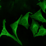 SPC-108_Calnexin_Antibody_ICC-IF_Human_HeLa-cells_1.png