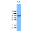 Rabbit Anti-Calnexin Antibody used in Western blot (WB) on Human HeLa cell lysates (SPC-108)