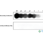 SPC-1097_WNK1-pSer382_Antibody_SPOT_1.png