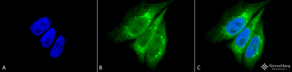 <p>Immunocytochemistry/Immunofluorescence analysis using Rabbit Anti-KDEL Polyclonal Antibody (SPC-109). Tissue: Heat Shocked Cervical cancer cell line (HeLa). Species: Human. Fixation: 2% Formaldehyde for 20 min at RT. Primary Antibody: Rabbit Anti-KDEL Polyclonal Antibody (SPC-109) at 1:100 for 12 hours at 4°C. Secondary Antibody: FITC Goat Anti-Rabbit (green) at 1:200 for 2 hours at RT. Counterstain: DAPI (blue) nuclear stain at 1:40000 for 2 hours at RT. Localization: Endoplasmic reticulum. Magnification: 100x. (A) DAPI (blue) nuclear stain. (B) Anti-KDEL Antibody. (C) Composite. Heat Shocked at 42°C for 30 min.</p>
