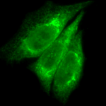 SPC-109_KDEL_Antibody_ICC-IF_Human_Heat-Shocked-HeLa-Cells_100x_Composite.png