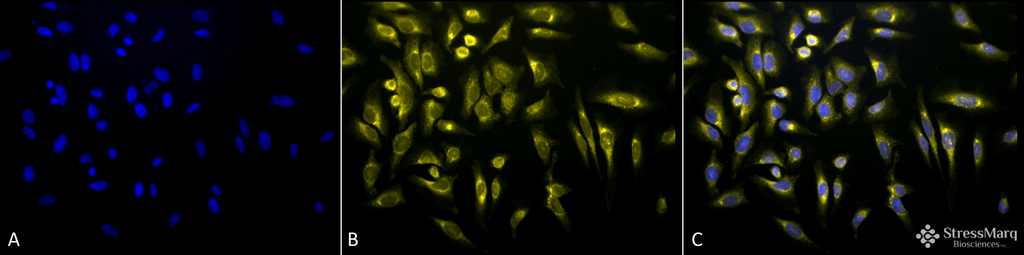 <p>Immunocytochemistry/Immunofluorescence analysis using Rabbit Anti-KDEL Polyclonal Antibody (SPC-109). Tissue: Heat Shocked Cervical cancer cell line (HeLa). Species: Human. Fixation: 2% Formaldehyde for 20 min at RT. Primary Antibody: Rabbit Anti-KDEL Polyclonal Antibody (SPC-109) at 1:100 for 12 hours at 4°C. Secondary Antibody: R-PE Goat Anti-Rabbit (yellow) at 1:200 for 2 hours at RT. Counterstain: DAPI (blue) nuclear stain at 1:40000 for 2 hours at RT. Localization: Endoplasmic reticulum. Magnification: 20x. (A) DAPI (blue) nuclear stain. (B) Anti-KDEL Antibody. (C) Composite. Heat Shocked at 42°C for 30 min.</p>
