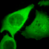 Rabbit Anti-HO-1 Antibody used in Immunocytochemistry/Immunofluorescence (ICC/IF) on Human HeLa Cells  (SPC-112)