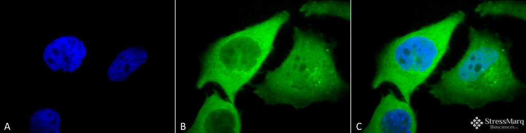 <p>Immunocytochemistry/Immunofluorescence analysis using Rabbit Anti-HO-1 Polyclonal Antibody (SPC-112). Tissue: Cervical cancer cell line (HeLa). Species: Human. Fixation: 2% Formaldehyde for 20 min at RT. Primary Antibody: Rabbit Anti-HO-1 Polyclonal Antibody (SPC-112) at 1:120 for 12 hours at 4°C. Secondary Antibody: FITC Goat Anti-Rabbit (green) at 1:200 for 2 hours at RT. Counterstain: DAPI (blue) nuclear stain at 1:40000 for 2 hours at RT. Localization: Endoplasmic reticulum membrane. Cytoplasm. Magnification: 100x. (A) DAPI (blue) nuclear stain. (B) Anti-HO-1 Antibody. (C) Composite.</p>
