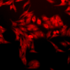 Rabbit Anti-HO-1 Antibody used in Immunocytochemistry/Immunofluorescence (ICC/IF) on Human Heat Shocked HeLa Cells (SPC-112)