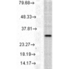 Rabbit Anti-HO-1 Antibody used in Western blot (WB) on Human Cell line lysates (SPC-112)