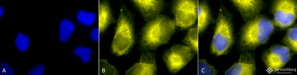 <p>Immunocytochemistry/Immunofluorescence analysis using Rabbit Anti-PDI Polyclonal Antibody (SPC-114). Tissue: Cervical cancer cell line (HeLa). Species: Human. Fixation: 2% Formaldehyde for 20 min at RT. Primary Antibody: Rabbit Anti-PDI Polyclonal Antibody (SPC-114) at 1:100 for 12 hours at 4°C. Secondary Antibody: R-PE Goat Anti-Rabbit (yellow) at 1:200 for 2 hours at RT. Counterstain: DAPI (blue) nuclear stain at 1:40000 for 2 hours at RT. Localization: Endoplasmic reticulum lumen. Melanosome. Magnification: 100x. (A) DAPI (blue) nuclear stain. (B) Anti-PDI Antibody. (C) Composite.</p>
