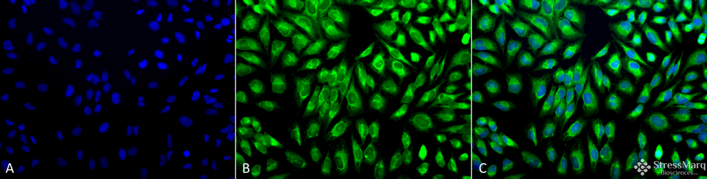 <p>Immunocytochemistry/Immunofluorescence analysis using Rabbit Anti-PDI Polyclonal Antibody (SPC-114). Tissue: Cervical cancer cell line (HeLa). Species: Human. Fixation: 2% Formaldehyde for 20 min at RT. Primary Antibody: Rabbit Anti-PDI Polyclonal Antibody (SPC-114) at 1:100 for 12 hours at 4°C. Secondary Antibody: FITC Goat Anti-Rabbit (green) at 1:200 for 2 hours at RT. Counterstain: DAPI (blue) nuclear stain at 1:40000 for 2 hours at RT. Localization: Endoplasmic reticulum lumen. Melanosome. Magnification: 20x. (A) DAPI (blue) nuclear stain. (B) Anti-PDI Antibody. (C) Composite.</p>
