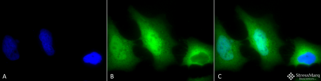 <p>Immunocytochemistry/Immunofluorescence analysis using Rabbit Anti-SOD (Cu/Zn) Polyclonal Antibody (SPC-115). Tissue: Cervical cancer cell line (HeLa). Species: Human. Fixation: 2% Formaldehyde for 20 min at RT. Primary Antibody: Rabbit Anti-SOD (Cu/Zn) Polyclonal Antibody (SPC-115) at 1:120 for 12 hours at 4°C. Secondary Antibody: FITC Goat Anti-Rabbit (green) at 1:200 for 2 hours at RT. Counterstain: DAPI (blue) nuclear stain at 1:40000 for 2 hours at RT. Localization: Cytoplasm. Nucleus. Magnification: 100x. (A) DAPI (blue) nuclear stain. (B) Anti-SOD (Cu/Zn) Antibody. (C) Composite.</p>

