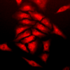 Rabbit Anti-SOD (Cu/Zn) Antibody used in Immunocytochemistry/Immunofluorescence (ICC/IF) on Human HeLa Cells (SPC-115)