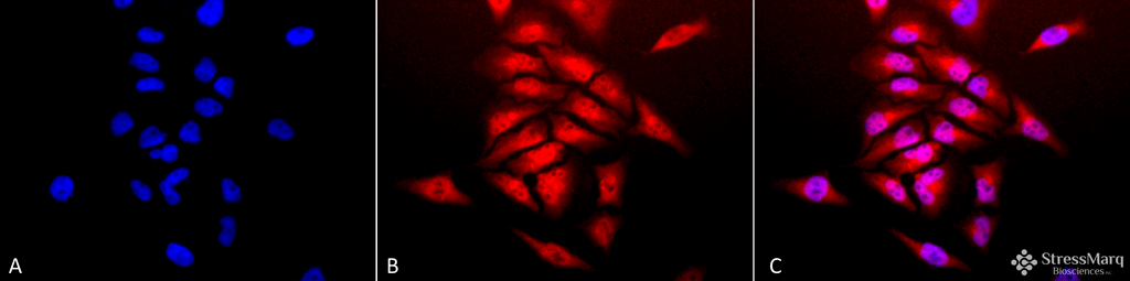 <p>Immunocytochemistry/Immunofluorescence analysis using Rabbit Anti-SOD (Cu/Zn) Polyclonal Antibody (SPC-115). Tissue: Cervical cancer cell line (HeLa). Species: Human. Fixation: 2% Formaldehyde for 20 min at RT. Primary Antibody: Rabbit Anti-SOD (Cu/Zn) Polyclonal Antibody (SPC-115) at 1:120 for 12 hours at 4°C. Secondary Antibody: APC Goat Anti-Rabbit (red) at 1:200 for 2 hours at RT. Counterstain: DAPI (blue) nuclear stain at 1:40000 for 2 hours at RT. Localization: Cytoplasm. Nucleus. Magnification: 20x. (A) DAPI (blue) nuclear stain. (B) Anti-SOD (Cu/Zn) Antibody. (C) Composite.</p>
