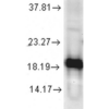 Rabbit Anti-SOD1 Antibody used in Western blot (WB) on Human Cell line lysates (SPC-115)