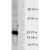 Rabbit Anti-SOD1 Antibody used in Western blot (WB) on Human Cell line lysates (SPC-116)
