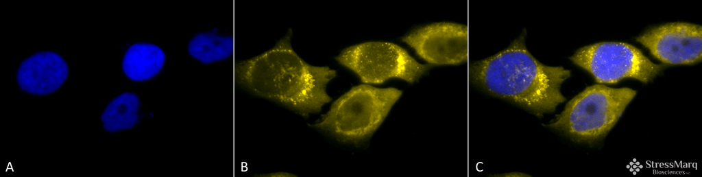 <p>Immunocytochemistry/Immunofluorescence analysis using Rabbit Anti-SOD (Mn) Polyclonal Antibody (SPC-117). Tissue: Cervical cancer cell line (HeLa). Species: Human. Fixation: 2% Formaldehyde for 20 min at RT. Primary Antibody: Rabbit Anti-SOD (Mn) Polyclonal Antibody (SPC-117) at 1:120 for 12 hours at 4°C. Secondary Antibody: R-PE Goat Anti-Rabbit (yellow) at 1:200 for 2 hours at RT. Counterstain: DAPI (blue) nuclear stain at 1:40000 for 2 hours at RT. Localization: Mitochondrion matrix. Magnification: 100x. (A) DAPI (blue) nuclear stain. (B) Anti-SOD (Mn) Antibody. (C) Composite.</p>
