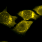 SPC-117_SOD-Mn_Antibody_ICC-IF_Human_HeLa-Cells_100x_Composite.png