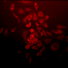 Rabbit Anti-SOD (Mn) Antibody used in Immunocytochemistry/Immunofluorescence (ICC/IF) on Human Cervical cancer cell line (HeLa) (SPC-117)