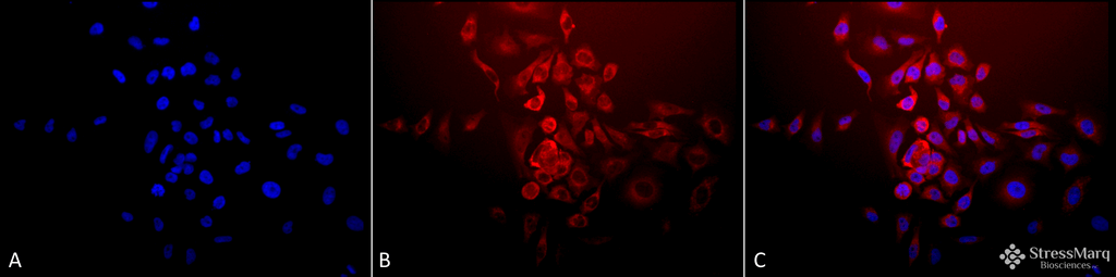 <p>Immunocytochemistry/Immunofluorescence analysis using Rabbit Anti-SOD (Mn) Polyclonal Antibody (SPC-117). Tissue: Cervical cancer cell line (HeLa). Species: Human. Fixation: 2% Formaldehyde for 20 min at RT. Primary Antibody: Rabbit Anti-SOD (Mn) Polyclonal Antibody (SPC-117) at 1:120 for 12 hours at 4°C. Secondary Antibody: APC Goat Anti-Rabbit (red) at 1:200 for 2 hours at RT. Counterstain: DAPI (blue) nuclear stain at 1:40000 for 2 hours at RT. Localization: Mitochondrion matrix. Magnification: 20x. (A) DAPI (blue) nuclear stain. (B) Anti-SOD (Mn) Antibody. (C) Composite.</p>
