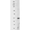 Rabbit Anti-SOD2 Antibody used in Western blot (WB) on Rat Tissue lysates (SPC-117)