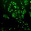 Rabbit Anti-Ubiquitin Antibody used in Immunocytochemistry/Immunofluorescence (ICC/IF) on Human Cervical cancer cell line (HeLa) (SPC-119)