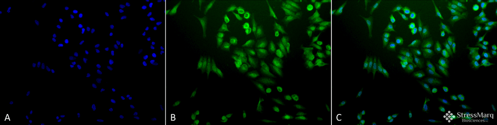 <p>Immunocytochemistry/Immunofluorescence analysis using Rabbit Anti-Ubiquitin Polyclonal Antibody (SPC-119). Tissue: Cervical cancer cell line (HeLa). Species: Human. Fixation: 2% Formaldehyde for 20 min at RT. Primary Antibody: Rabbit Anti-Ubiquitin Polyclonal Antibody (SPC-119) at 1:200 for 12 hours at 4°C. Secondary Antibody: FITC Goat Anti-Rabbit (green) at 1:200 for 2 hours at RT. Counterstain: DAPI (blue) nuclear stain at 1:40000 for 2 hours at RT. Localization: Cytoplasm. Magnification: 20x. (A) DAPI (blue) nuclear stain. (B) Anti-Ubiquitin Antibody. (C) Composite.</p>

