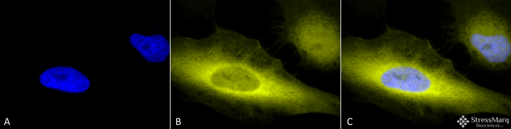 <p>Immunocytochemistry/Immunofluorescence analysis using Rabbit Anti-Ubiquitin Polyclonal Antibody (SPC-119). Tissue: Heat Shocked Cervical cancer cell line (HeLa). Species: Human. Fixation: 2% Formaldehyde for 20 min at RT. Primary Antibody: Rabbit Anti-Ubiquitin Polyclonal Antibody (SPC-119) at 1:100 for 12 hours at 4°C. Secondary Antibody: R-PE Goat Anti-Rabbit (yellow) at 1:200 for 2 hours at RT. Counterstain: DAPI (blue) nuclear stain at 1:40000 for 2 hours at RT. Localization: Cytoplasm. Magnification: 100x. (A) DAPI (blue) nuclear stain. (B) Anti-Ubiquitin Antibody. (C) Composite. Heat Shocked at 42°C for 1h.</p>
