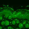 Rabbit Anti-Ubiquitin Antibody used in Immunohistochemistry (IHC) on Mouse backskin (SPC-119)