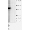 Rabbit Anti-ERK1 Antibody used in Western blot (WB) on Human Cell line lysates (SPC-120)