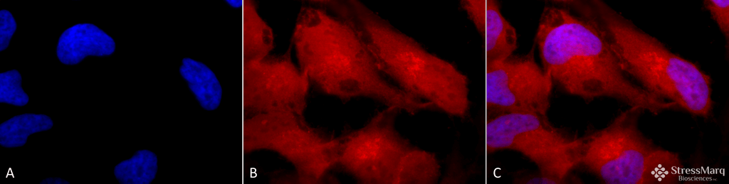 <p>Immunocytochemistry/Immunofluorescence analysis using Rabbit Anti-Erk1/2 Polyclonal Antibody (SPC-120). Tissue: Cervical cancer cell line (HeLa). Species: Human. Fixation: 2% Formaldehyde for 20 min at RT. Primary Antibody: Rabbit Anti-Erk1/2 Polyclonal Antibody (SPC-120) at 1:100 for 12 hours at 4°C. Secondary Antibody: APC Goat Anti-Rabbit (red) at 1:200 for 2 hours at RT. Counterstain: DAPI (blue) nuclear stain at 1:40000 for 2 hours at RT. Localization: Cytoplasm. Nucleus. Magnification: 100x. (A) DAPI (blue) nuclear stain. (B) Anti-Erk1/2 Antibody. (C) Composite.</p>
