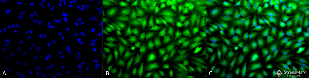 <p>Immunocytochemistry/Immunofluorescence analysis using Rabbit Anti-Erk1/2 Polyclonal Antibody (SPC-120). Tissue: Cervical cancer cell line (HeLa). Species: Human. Fixation: 2% Formaldehyde for 20 min at RT. Primary Antibody: Rabbit Anti-Erk1/2 Polyclonal Antibody (SPC-120) at 1:100 for 12 hours at 4°C. Secondary Antibody: FITC Goat Anti-Rabbit (green) at 1:200 for 2 hours at RT. Counterstain: DAPI (blue) nuclear stain at 1:40000 for 2 hours at RT. Localization: Cytoplasm. Nucleus. Magnification: 20x. (A) DAPI (blue) nuclear stain. (B) Anti-Erk1/2 Antibody. (C) Composite.</p>
