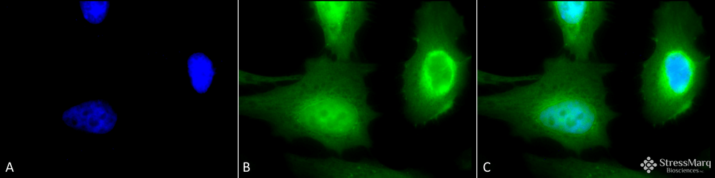 <p>Immunocytochemistry/Immunofluorescence analysis using Rabbit Anti-Calreticulin Polyclonal Antibody (SPC-122). Tissue: Heat Shocked Cervical cancer cell line (HeLa). Species: Human. Fixation: 2% Formaldehyde for 20 min at RT. Primary Antibody: Rabbit Anti-Calreticulin Polyclonal Antibody (SPC-122) at 1:100 for 12 hours at 4°C. Secondary Antibody: FITC Goat Anti-Rabbit (green) at 1:200 for 2 hours at RT. Counterstain: DAPI (blue) nuclear stain at 1:40000 for 2 hours at RT. Localization: Endoplasmic reticulum lumen. Cytoplasm. Magnification: 100x. (A) DAPI (blue) nuclear stain. (B) Anti-Calreticulin Antibody. (C) Composite. Heat Shocked at 42°C for 1h.</p>
