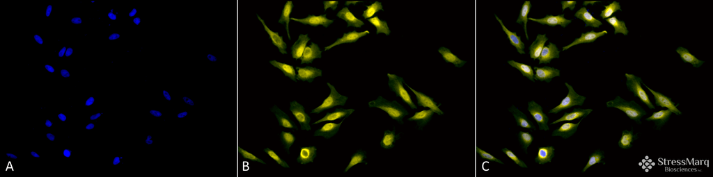 <p>Immunocytochemistry/Immunofluorescence analysis using Rabbit Anti-Calreticulin Polyclonal Antibody (SPC-122). Tissue: Heat Shocked Cervical cancer cell line (HeLa). Species: Human. Fixation: 2% Formaldehyde for 20 min at RT. Primary Antibody: Rabbit Anti-Calreticulin Polyclonal Antibody (SPC-122) at 1:100 for 12 hours at 4°C. Secondary Antibody: R-PE Goat Anti-Rabbit (yellow) at 1:200 for 2 hours at RT. Counterstain: DAPI (blue) nuclear stain at 1:40000 for 2 hours at RT. Localization: Endoplasmic reticulum lumen. Cytoplasm. Magnification: 20x. (A) DAPI (blue) nuclear stain. (B) Anti-Calreticulin Antibody. (C) Composite. Heat Shocked at 42°C for 1h.</p>
