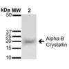 Rabbit Anti-Alpha B Crystallin Antibody used in Western blot (WB) on Brain cell lysates (SPC-126)