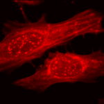 SPC-126_Alpha-B-Crystallin_Antibody_ICC-IF_Human_Heat-Shocked-HeLa-Cells_100x_Composite.png