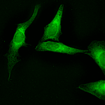 SPC-127_Calnexin_Antibody_ICC-IF_Human_HeLa-cells_1.png