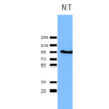 Rabbit Anti-Calnexin Antibody used in Western blot (WB) on Human Cervical cancer cell line (HeLa) lysate (SPC-127)