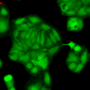 Rabbit Anti-Rab4 Antibody used in Immunocytochemistry/Immunofluorescence (ICC/IF) on Human HaCaT cells (SPC-141)