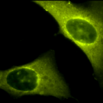 SPC-141_Rab4_Antibody_ICC-IF_Human_Heat-Shocked-HeLa-Cells_100x_Composite.png